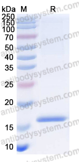 Anti-Human CD309/KDR/VEGFR-2 Nanobody (SAA1230)