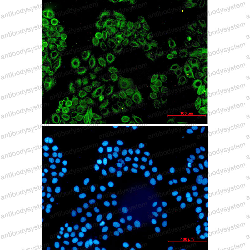 Anti-ACVR1B Antibody (R1V39)