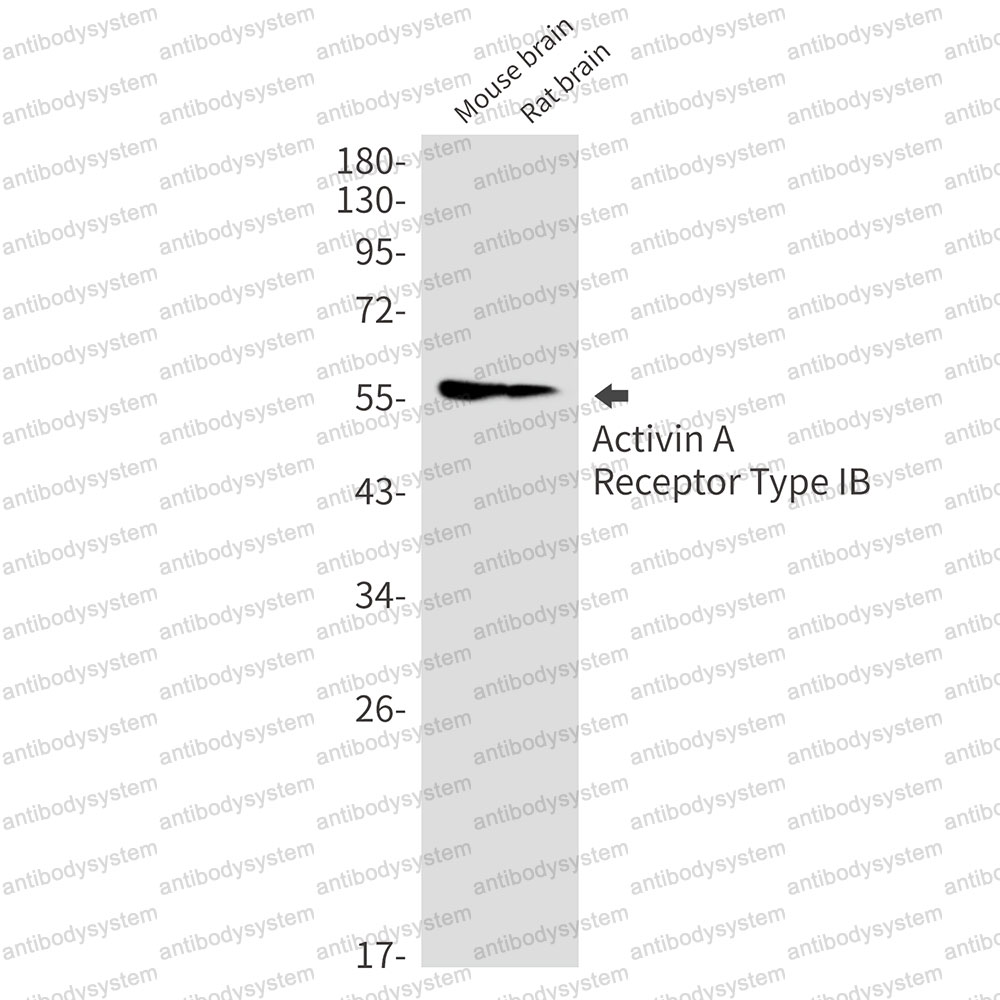 Anti-ACVR1B Antibody (R1V38)