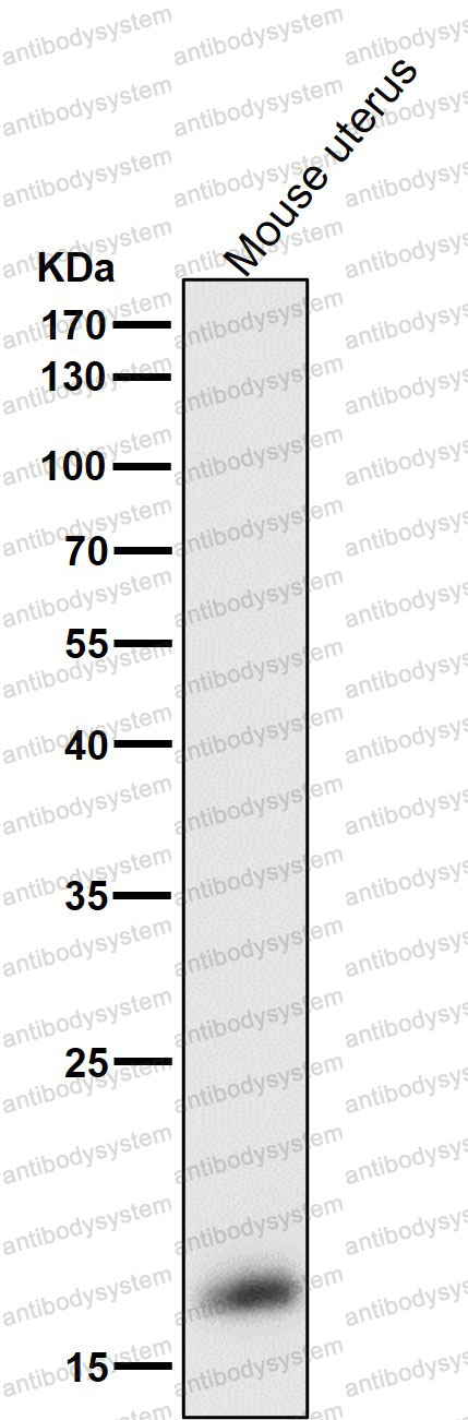 Anti-GPX4/PHGPx Antibody (R1V41)
