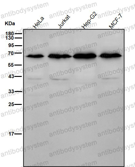 Anti-ACVRL1 Antibody (R1V43)
