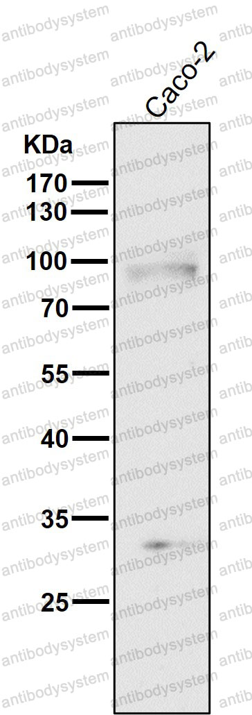 Anti-TGFBR2/TGFR-2 Antibody (R1V44)