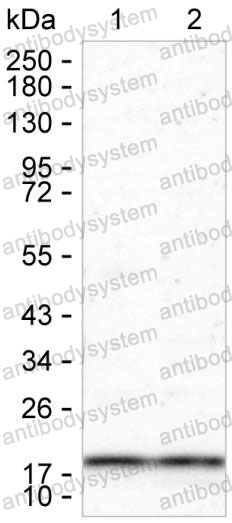 Anti-HPCAL1 Antibody (R3K10)