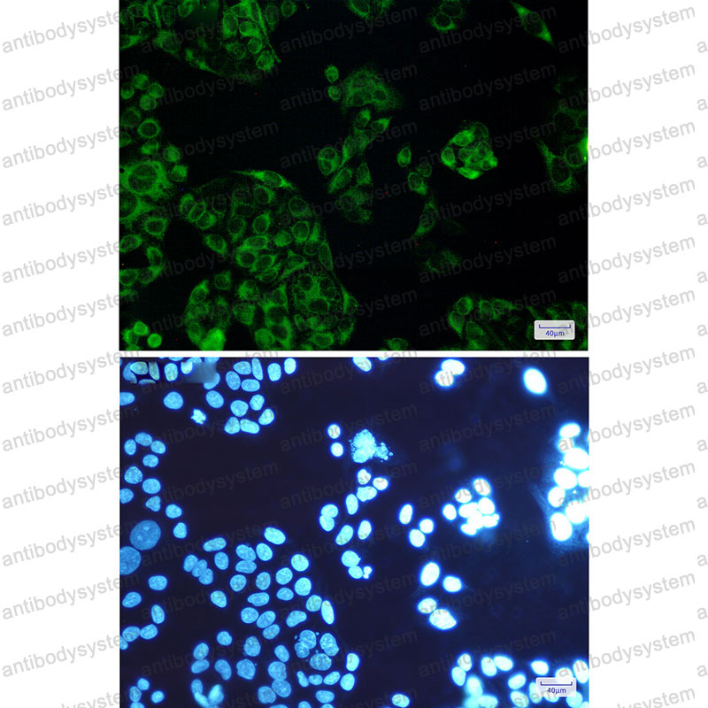 Anti-FDFT1 Antibody (R1V47)