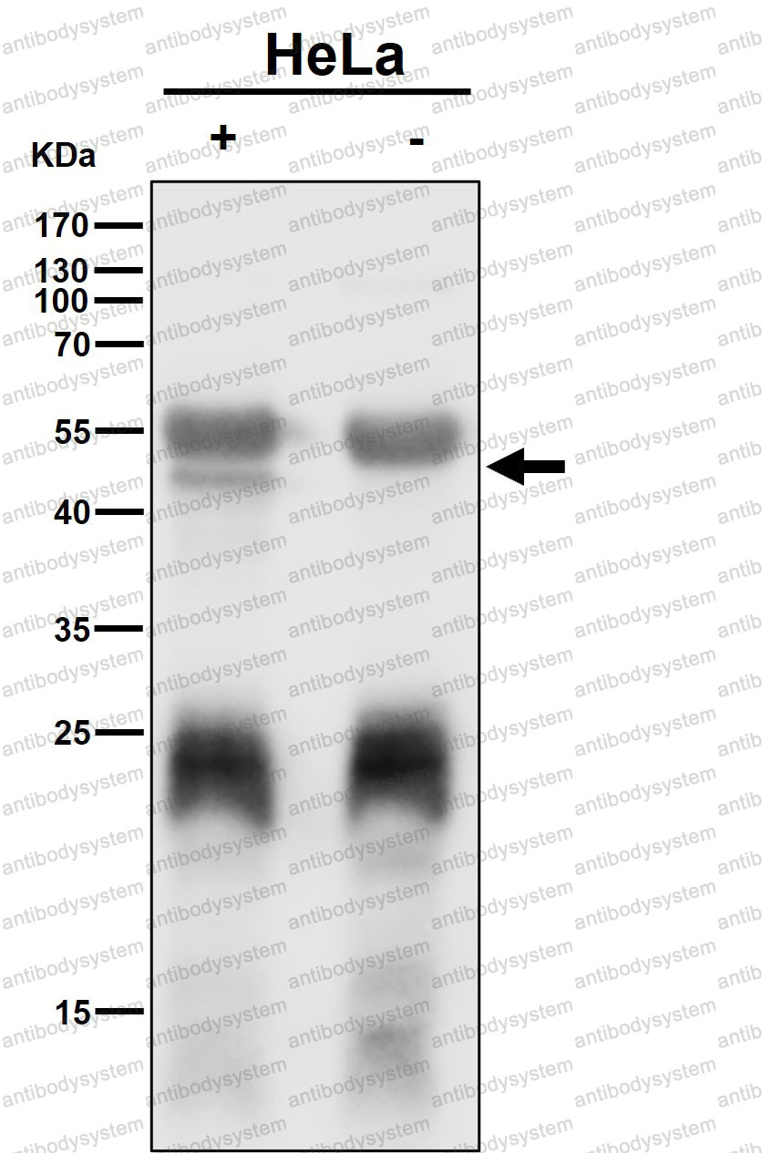 Anti-FDFT1 Antibody (R1V46)