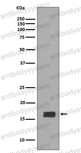 Anti-Alpha/beta-synuclein Antibody (R1B39)