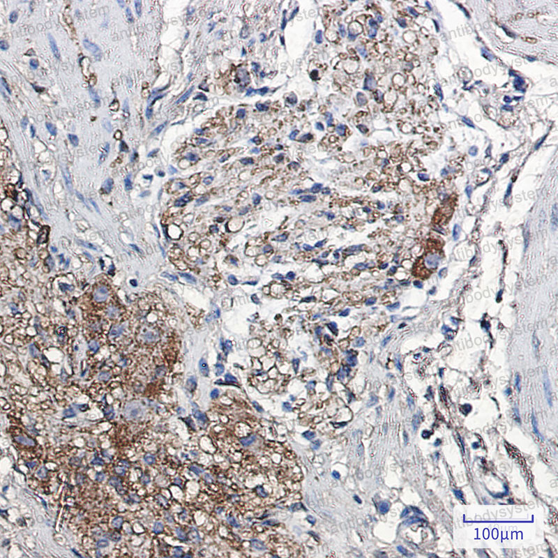 Anti-SNCA/Alpha-synuclein Antibody (R1V48)
