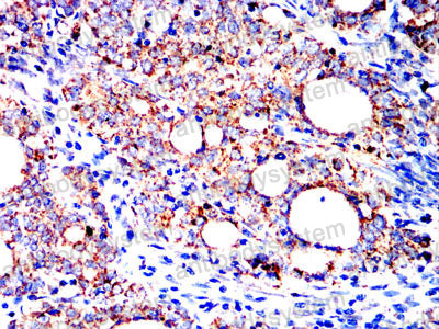 Immunohistochemical for Anti-HSPA9/Mortalin/GRP75 Antibody (R3K16) ?>