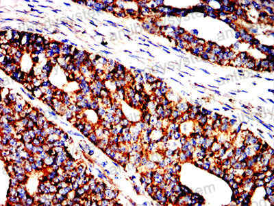 Immunohistochemical for Anti-HSPA9/Mortalin/GRP75 Antibody (R3K16) ?>