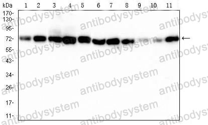 Western blot for Anti-HSPA9/Mortalin/GRP75 Antibody (R3K16) ?>