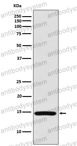 Anti-RPS19 Antibody (R1V59)