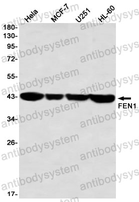Anti-FEN1 Antibody (R1V61)