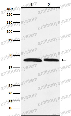 Anti-FEN1 Antibody (R1V60)