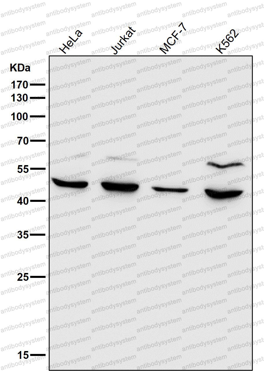 Anti-MMP12 Antibody (R1B42)
