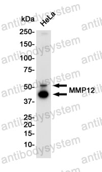 Anti-MMP12 Antibody (R1V62)