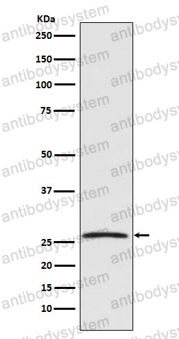 Anti-GDNF Antibody (R1V63)