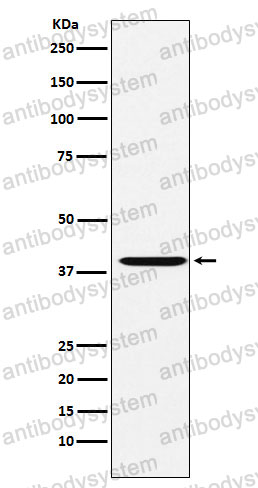 Anti-CAPG Antibody (R1V64)