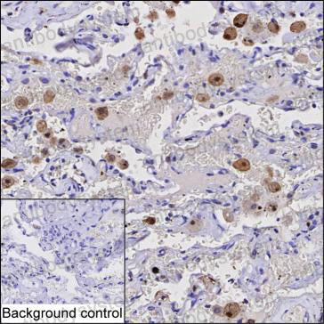 Immunohistochemical for Anti-CAPG Antibody (R3K22) ?>