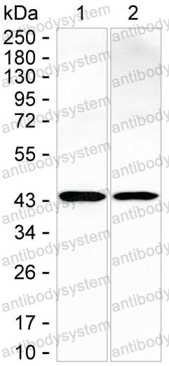 Western blot for Anti-CAPG Antibody (R3K22) ?>