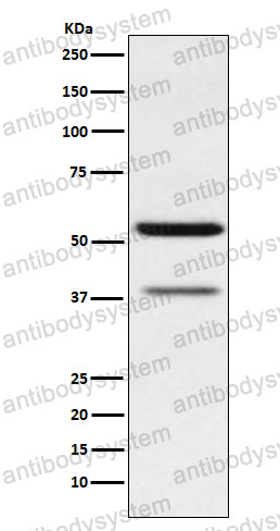 Anti-CD66c/CEACAM6 Antibody (R1V66)