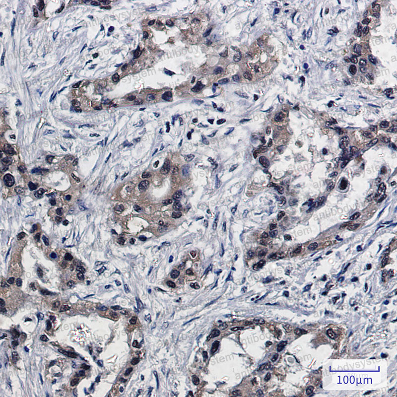 Anti-PSMB10 Antibody (R1V71)
