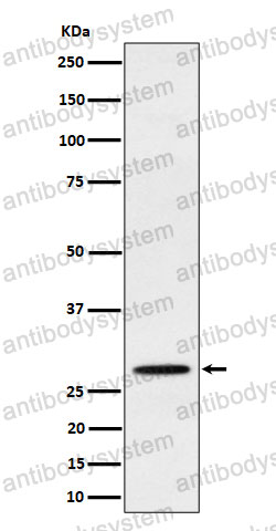 Anti-PSMB10 Antibody (R1V68)