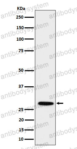 Anti-PSMB10 Antibody (R1V69)