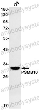 Anti-PSMB10 Antibody (R1V70)