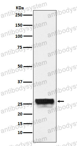 Anti-CTRL Antibody (R1V72)