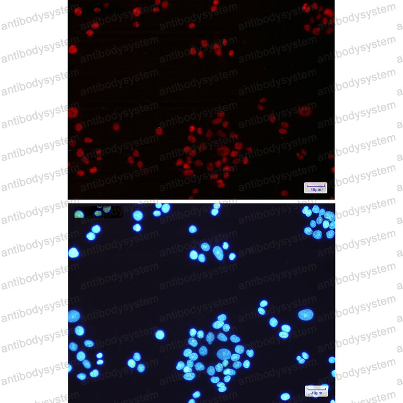 Anti-MLH1 Antibody (R1V73)