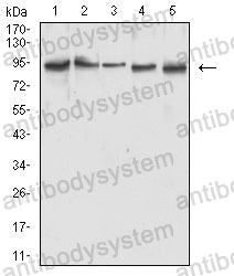 Western blot for Anti-MLH1 Antibody (R3K39) ?>