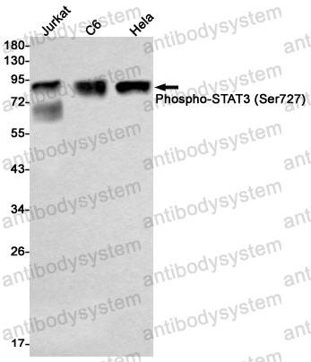 Anti-Phospho-STAT3 (Ser727) Antibody (R1V74)