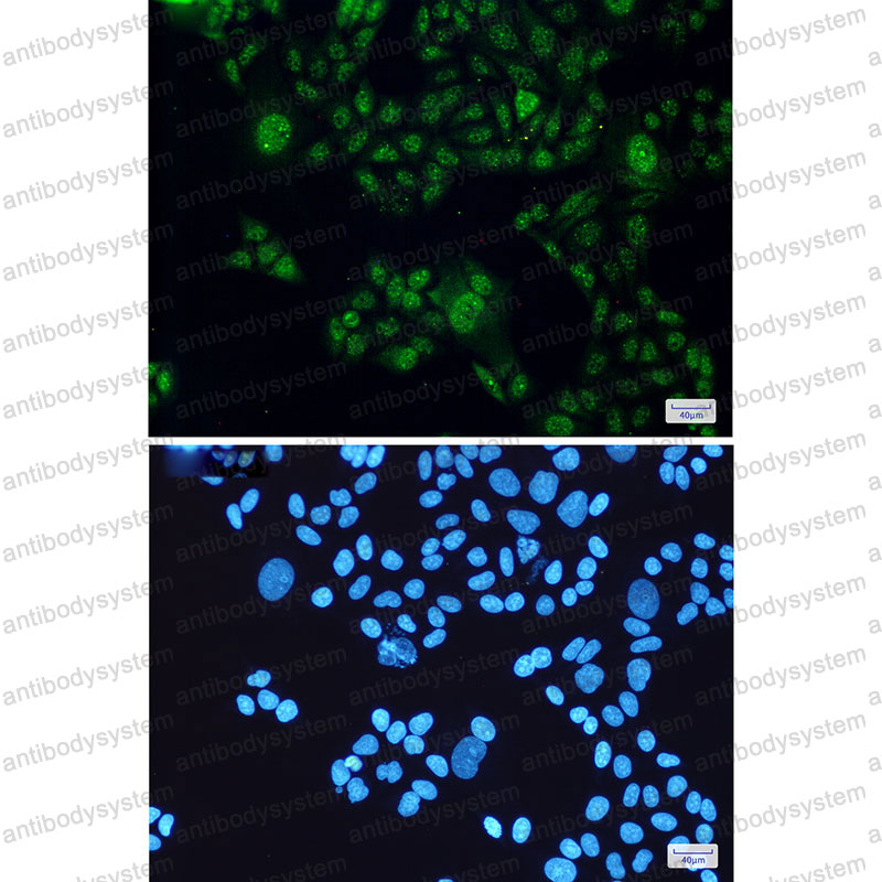 Anti-STAT3 Antibody (R1V75)