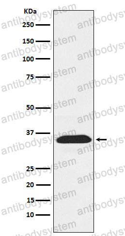 Anti-PEX19 Antibody (R1V76)