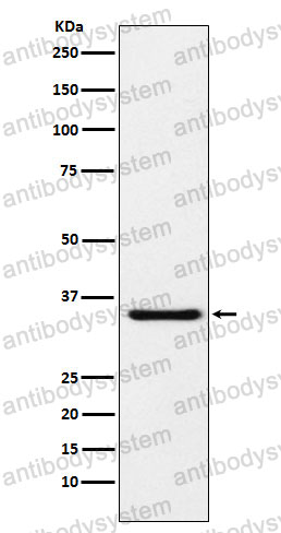 Anti-MDH1 Antibody (R1V77)