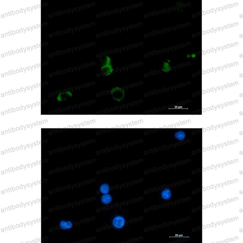 Immunofluorescence for Anti-PTGDS Antibody (R1V88) ?>