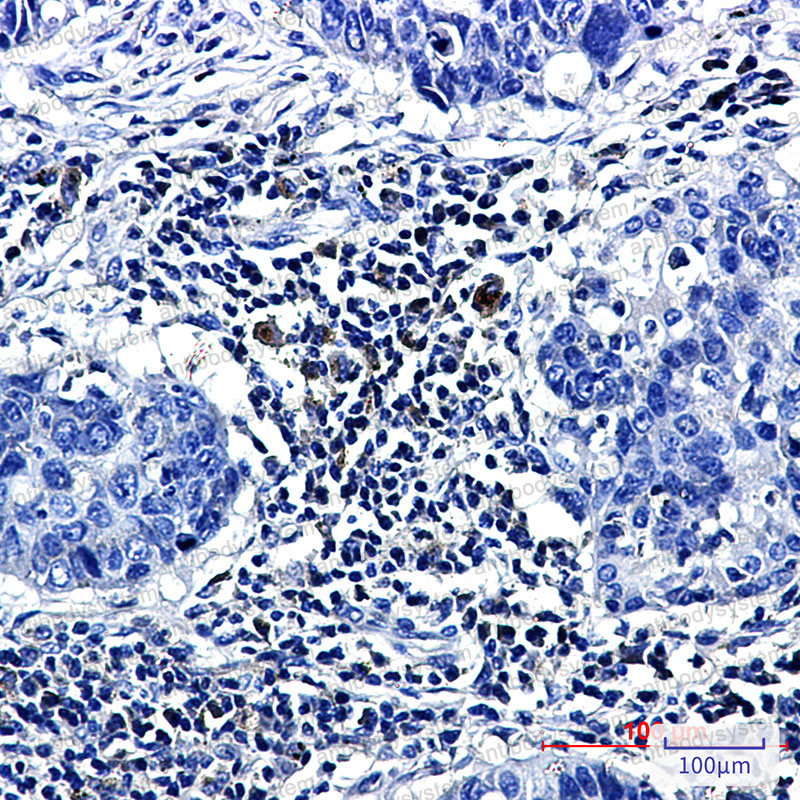 Immunohistochemical for Anti-PTGDS Antibody (R1V88) ?>