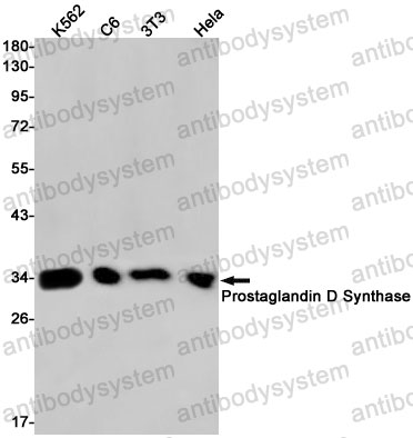 Western blot for Anti-PTGDS Antibody (R1V88) ?>