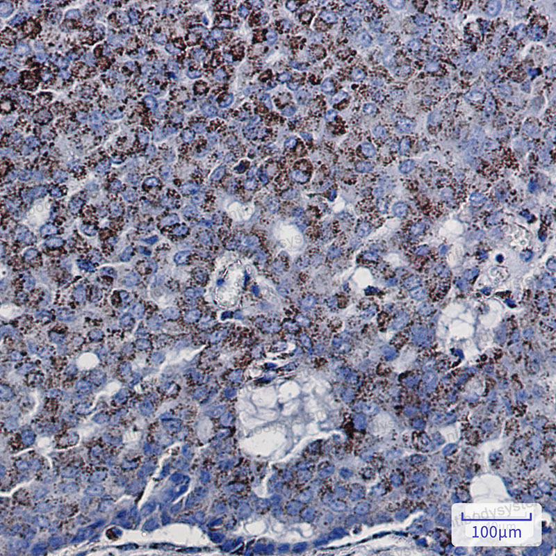 Immunohistochemical for Anti-ECI1 Antibody (R1V96) ?>