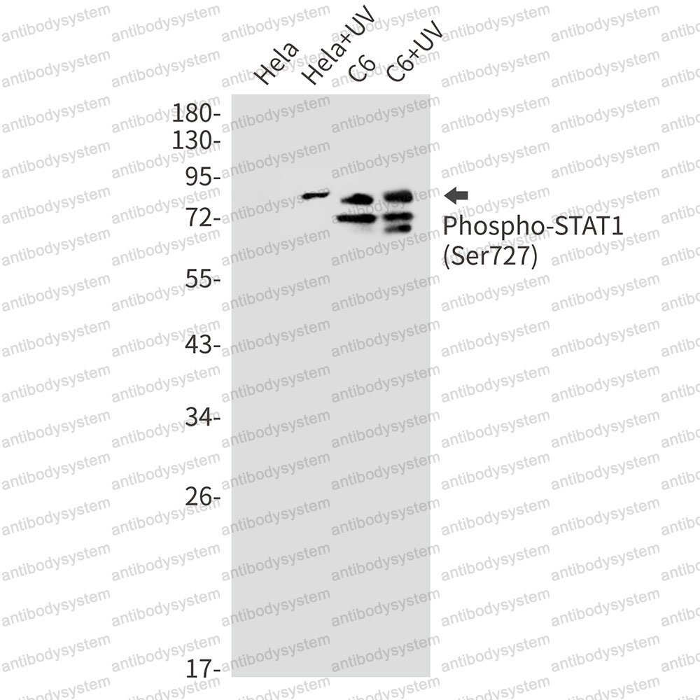 Anti-Phospho-STAT1 (Ser727) Antibody (R1W01)