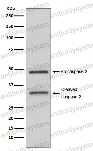 Anti-CASP2 Antibody (R1W23)