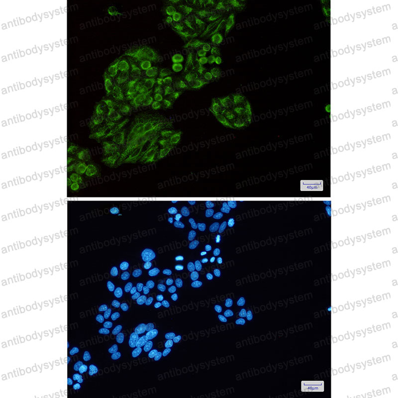 Anti-TEC Antibody (R1W24)