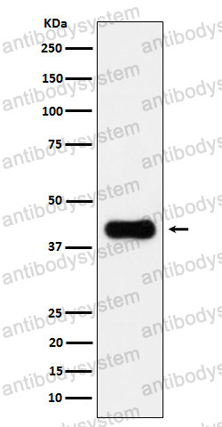 Anti-ACAA2 Antibody (R1W25)