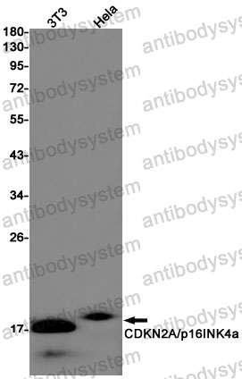 Anti-CDKN2A/p16INK4a Antibody (R1W29)