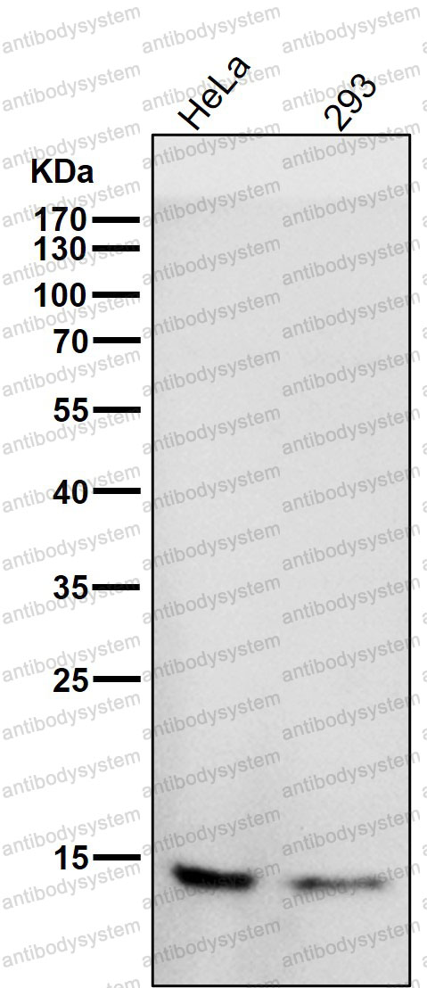 Anti-CDKN2A/p16INK4a Antibody (R1W26)