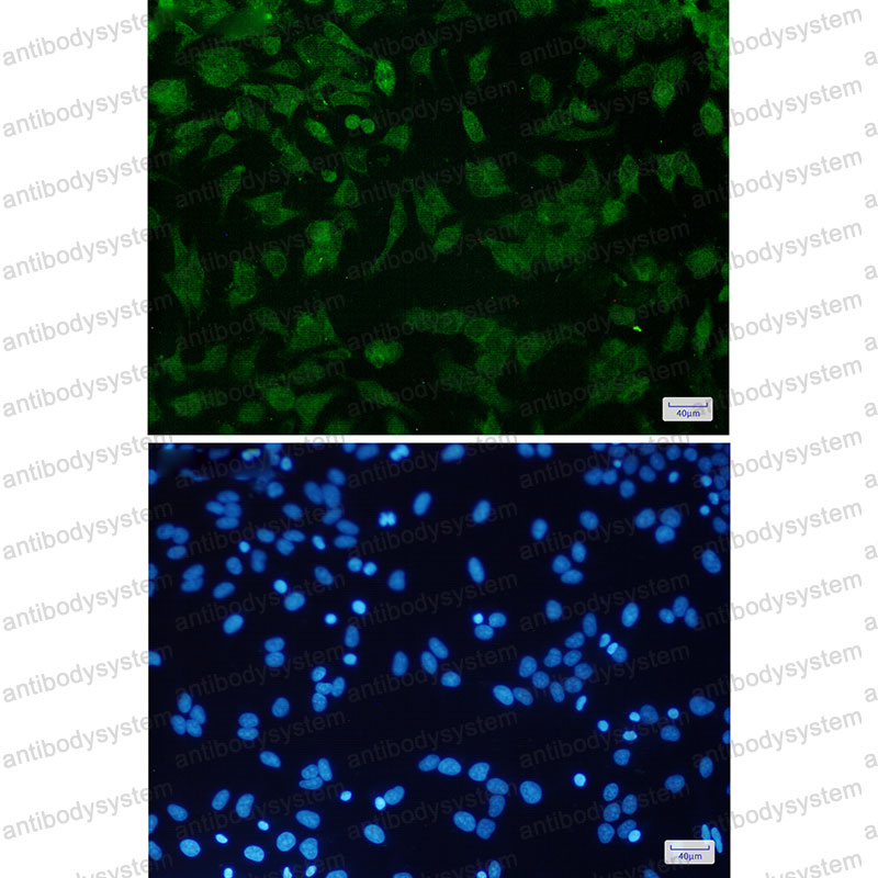 Anti-CDKN2A/p16INK4a Antibody (R1W27)
