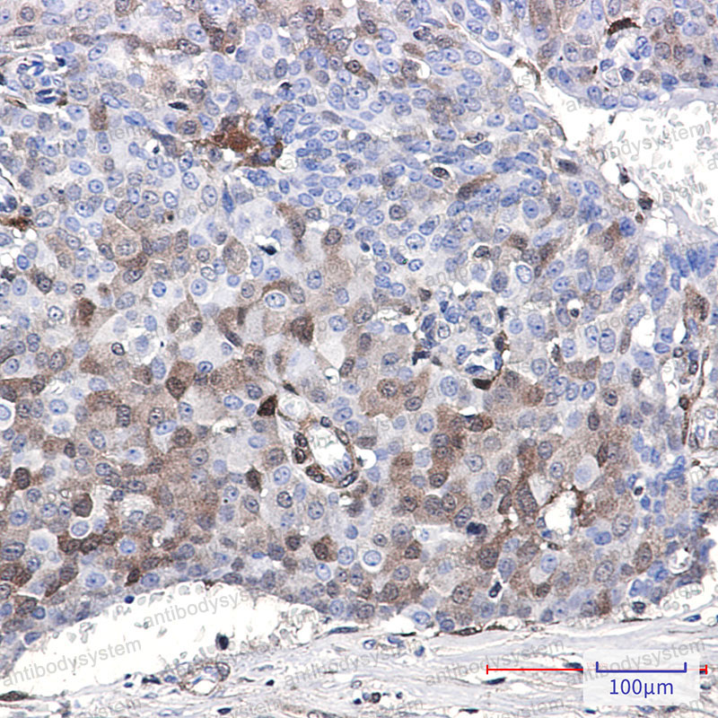 Anti-CDKN2C Antibody (R1W31)