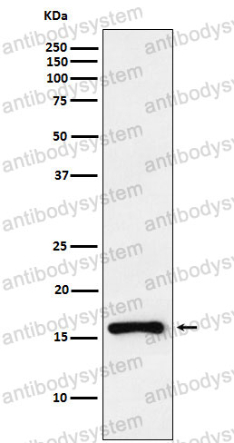 Anti-CDKN2C Antibody (R1W30)