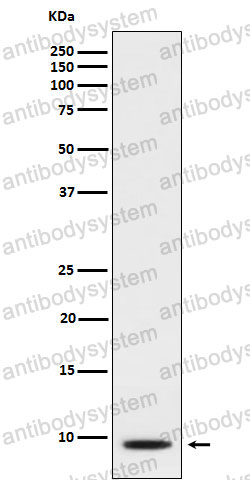 Anti-CXCL5/ENA-78 Antibody (R1W32)