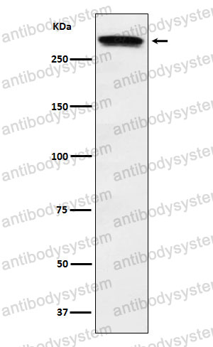 Anti-HTT Antibody (R1W33)